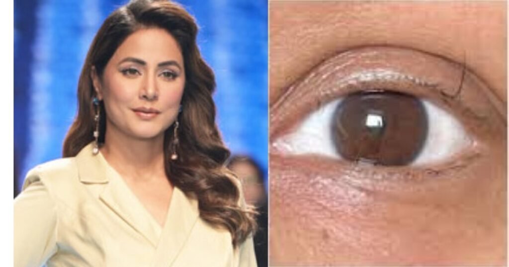 Hina Khan Reaches the Last Round of Chemotherapy; 'Last Standing Eyelash' Strengthens Her